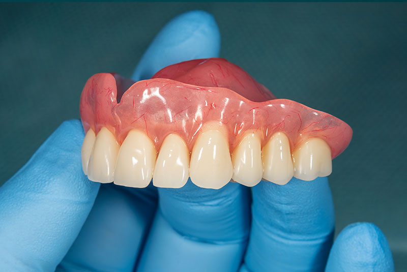 complete denture