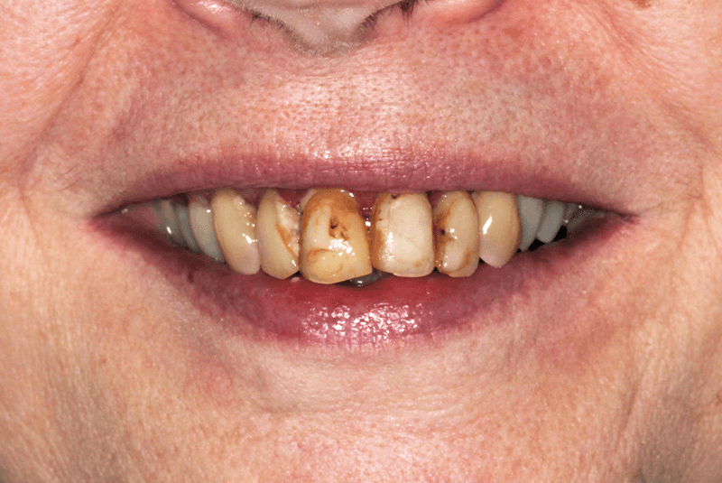 close up of before procedure