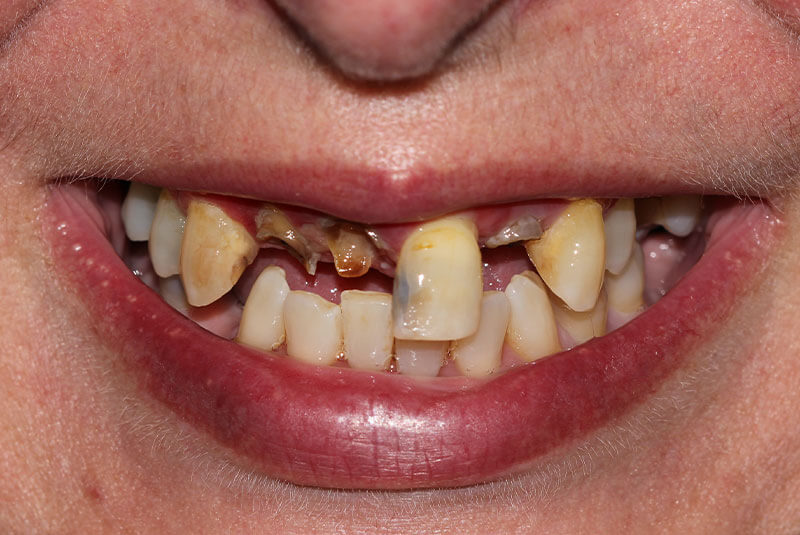 before procedure close up of patient