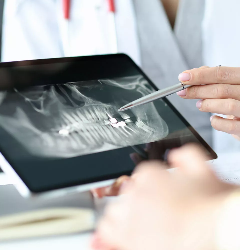 Tooth Extraction X-Ray Results